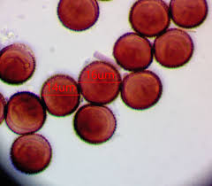 Attēlu rezultāti vaicājumam “Diderma subviridifuscum var. macrospora* sessile”