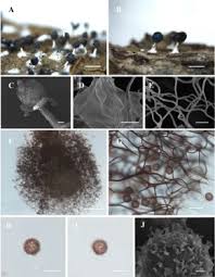 Attēlu rezultāti vaicājumam “Diachea subsessilis spores”
