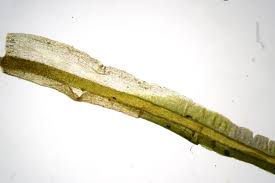 Attēlu rezultāti vaicājumam “Tortella tortuosa”