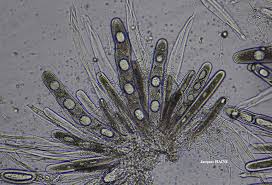 Attēlu rezultāti vaicājumam “Pertusaria leioplaca”