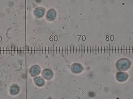 Attēlu rezultāti vaicājumam “Steccherinum bourdotii”