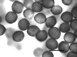 Attēlu rezultāti vaicājumam “Amaurochaete atra macro”