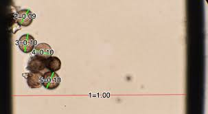 Attēlu rezultāti vaicājumam “Didymium megalosporum spores”