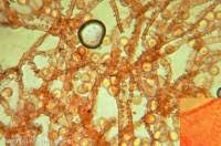 Attēlu rezultāti vaicājumam “Arcyria minuta”