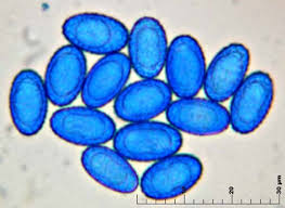 Attēlu rezultāti vaicājumam “Sowerbyella radiculata”