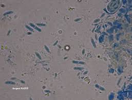 Attēlu rezultāti vaicājumam “Microcalicium disseminatum”