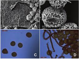 Attēlu rezultāti vaicājumam “Trichia crateriformis stalked”