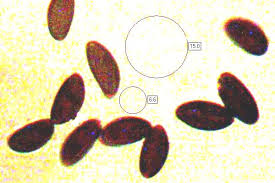 Attēlu rezultāti vaicājumam “Daldinia concentrica”