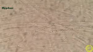 Attēlu rezultāti vaicājumam “Calocera glossoides”