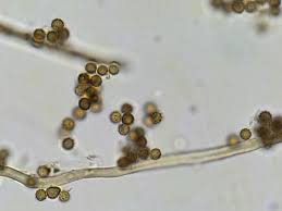 Attēlu rezultāti vaicājumam “Didymium serpula spores”