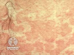 Attēlu rezultāti vaicājumam “Badhamia versicolor”