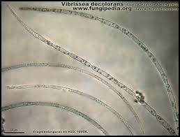 Attēlu rezultāti vaicājumam “Vibrissea decolorans”