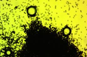 Attēlu rezultāti vaicājumam “Diderma spumarioides macro”