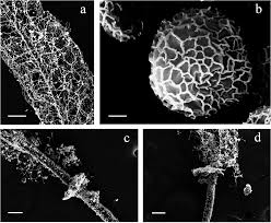 Attēlu rezultāti vaicājumam “Stemonitis flavogenita spores”