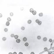 Attēlu rezultāti vaicājumam “Oligonema sp.”