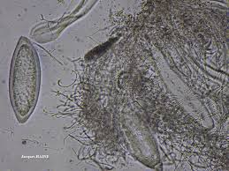 Attēlu rezultāti vaicājumam “Pertusaria pertusa”