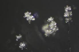 Attēlu rezultāti vaicājumam “Orbilia sp.”