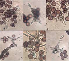 Attēlu rezultāti vaicājumam “Fuligo septica var. rosea plasmodium”