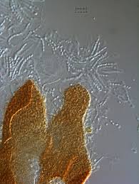 Attēlu rezultāti vaicājumam “Fuligo leviderma spores”