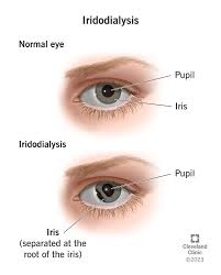 Image result for Iris
