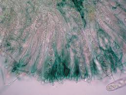 Attēlu rezultāti vaicājumam “Octosporella jungermanniarum”