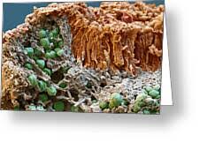 Attēlu rezultāti vaicājumam “Caloplaca saxicola”