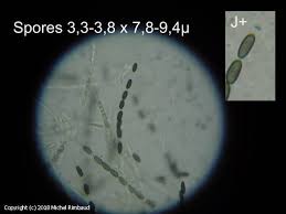 Attēlu rezultāti vaicājumam “Anthostoma decipiens”