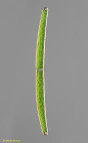 Attēlu rezultāti vaicājumam “Gloeocapsa rupestris”