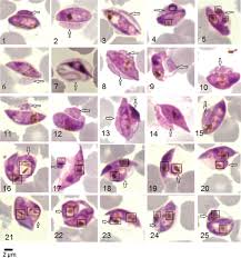 Attēlu rezultāti vaicājumam “Oligonema favogineum plasmodium”
