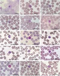 Attēlu rezultāti vaicājumam “Siphoptychium violaceum plasmodium”