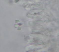 Attēlu rezultāti vaicājumam “Lycogala botrydium spores”