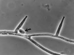 Attēlu rezultāti vaicājumam “Stemonitopsis aequalis var. microspora stalked”