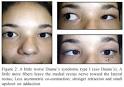 contracture (Figure 2).