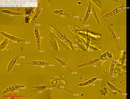 Attēlu rezultāti vaicājumam “Lachnum corticale”