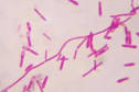 Botulism
