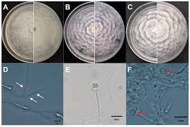 Attēlu rezultāti vaicājumam “Trichia alpina spores”