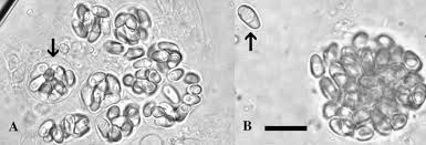 Attēlu rezultāti vaicājumam “Badhamia affinis var. microspora spores”