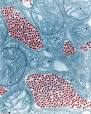 Eastern equine encephalitis virus - Wikipedia, the free encyclopedia