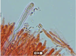 Attēlu rezultāti vaicājumam “Crustoderma dryinum”