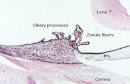 Example: Ciliary Body