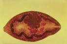 <b>Paragonimus westermani</b> is a