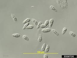 Attēlu rezultāti vaicājumam “Barbeyella minutissima spores”