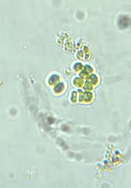 Attēlu rezultāti vaicājumam “Gloeocapsa rupestris”