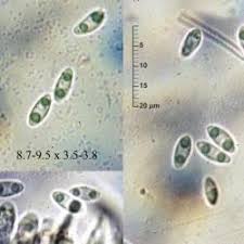 Attēlu rezultāti vaicājumam “Ionomidotis irregularis”