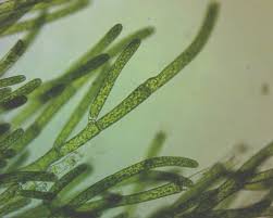 Attēlu rezultāti vaicājumam “Cladophora glomerata”