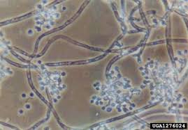 Attēlu rezultāti vaicājumam “Cribraria vulgaris spores”