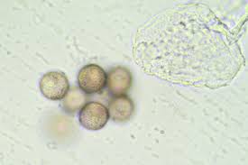 Attēlu rezultāti vaicājumam “Diderma effusum macro”