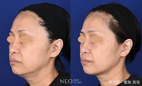 「エレア・サーブラフ」の画像検索結果