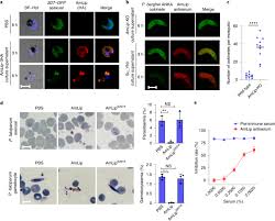 Attēlu rezultāti vaicājumam “Symphytocarpus trechisporus plasmodium”