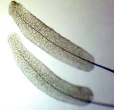 Attēlu rezultāti vaicājumam “Stemonitopsis aequalis var. microspora”